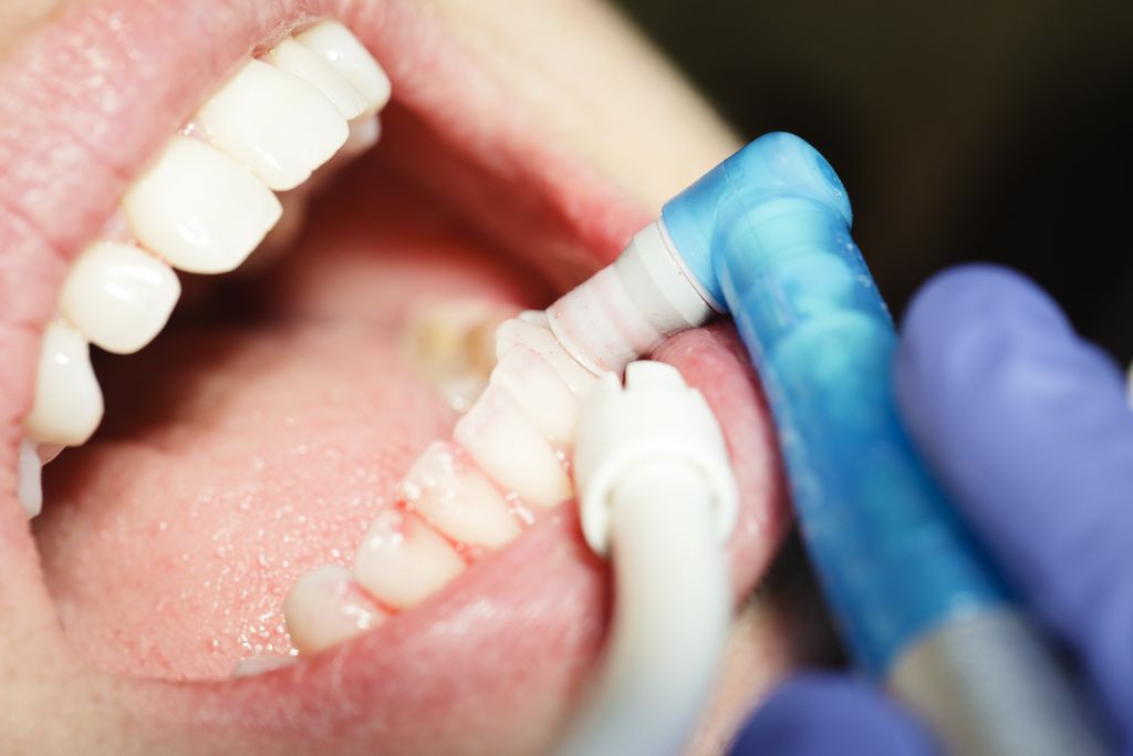 スケーリングやPMTC