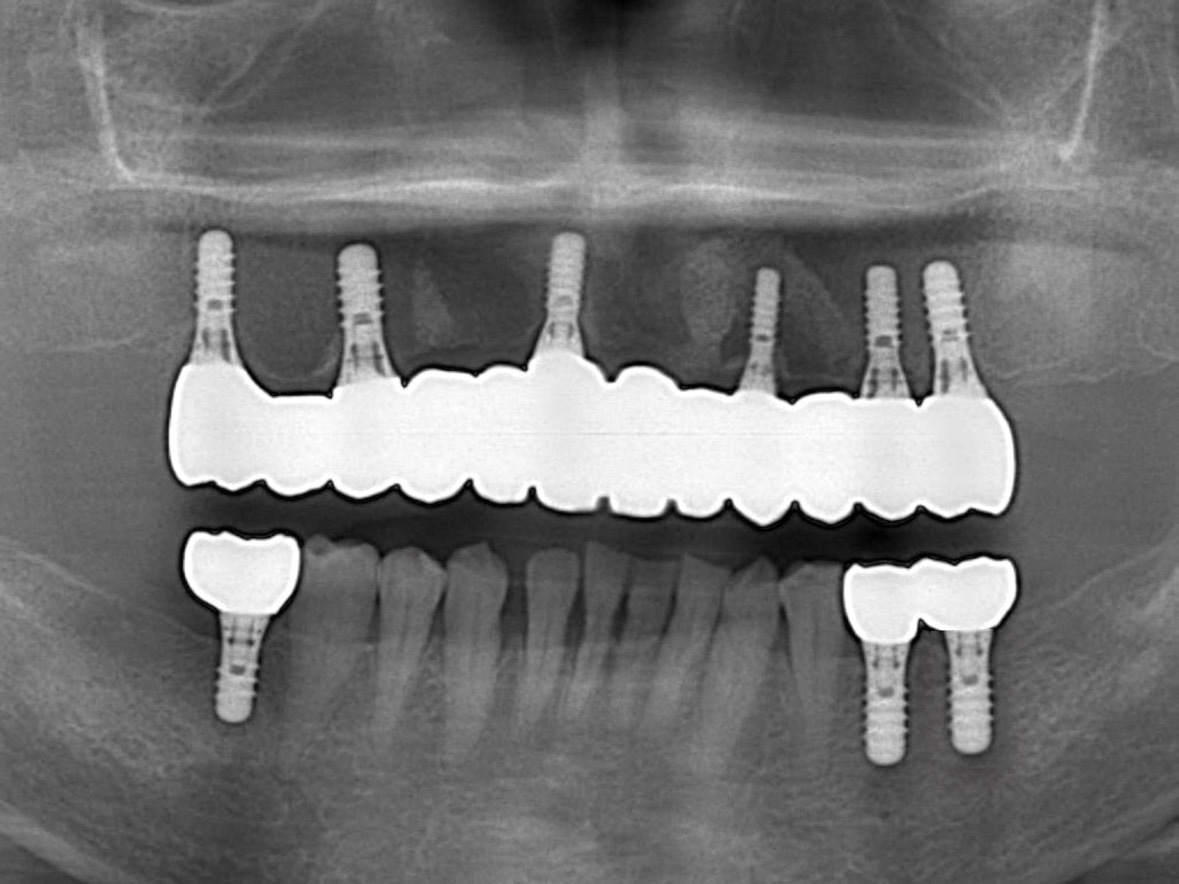 70代女性アフター