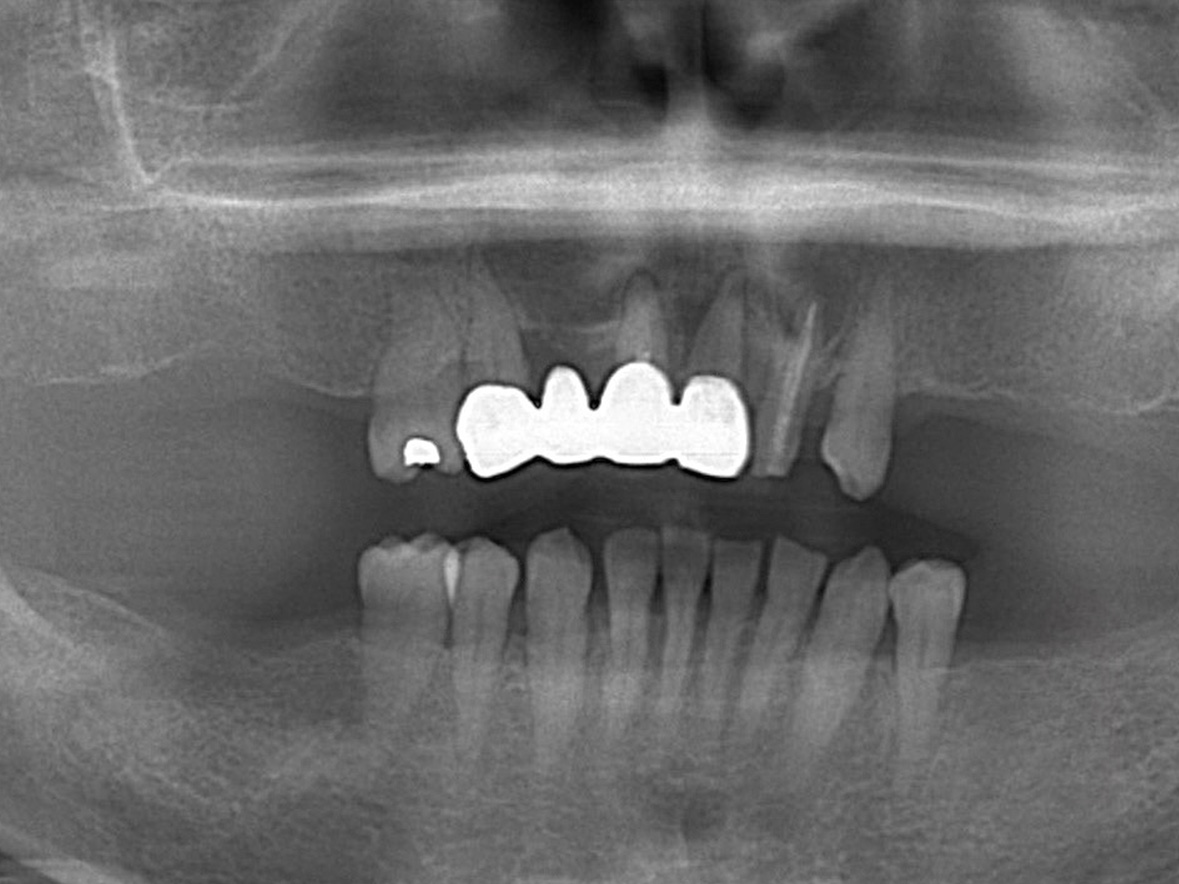 70代女性ビフォー