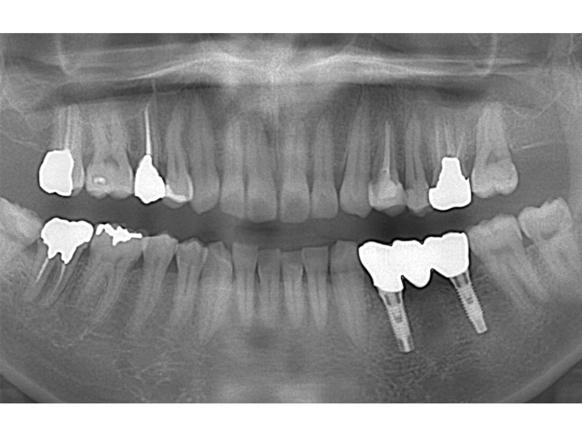 60代男性アフター