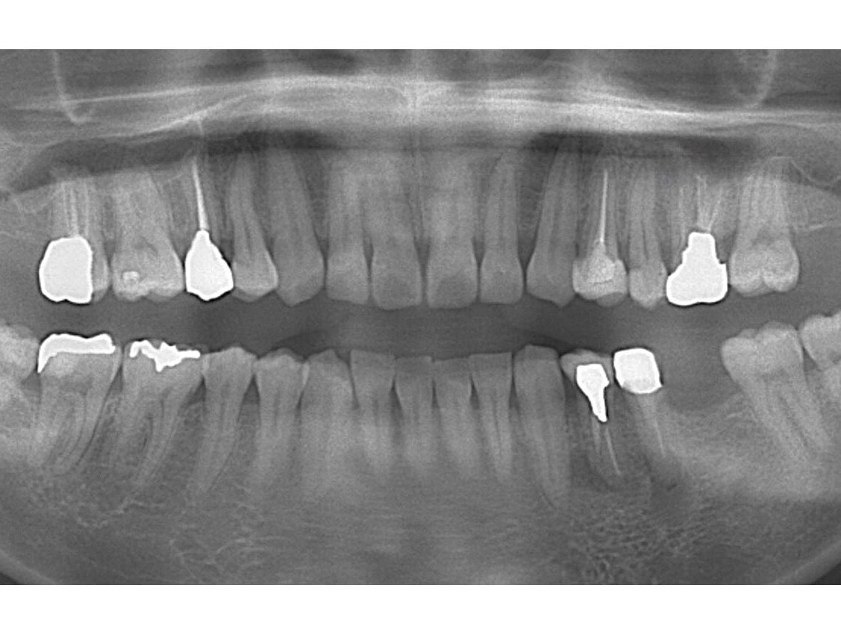 60代男性ビフォー