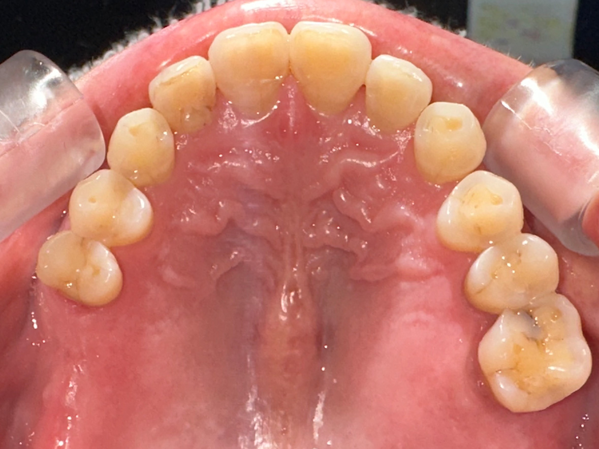 40代女性ビフォー