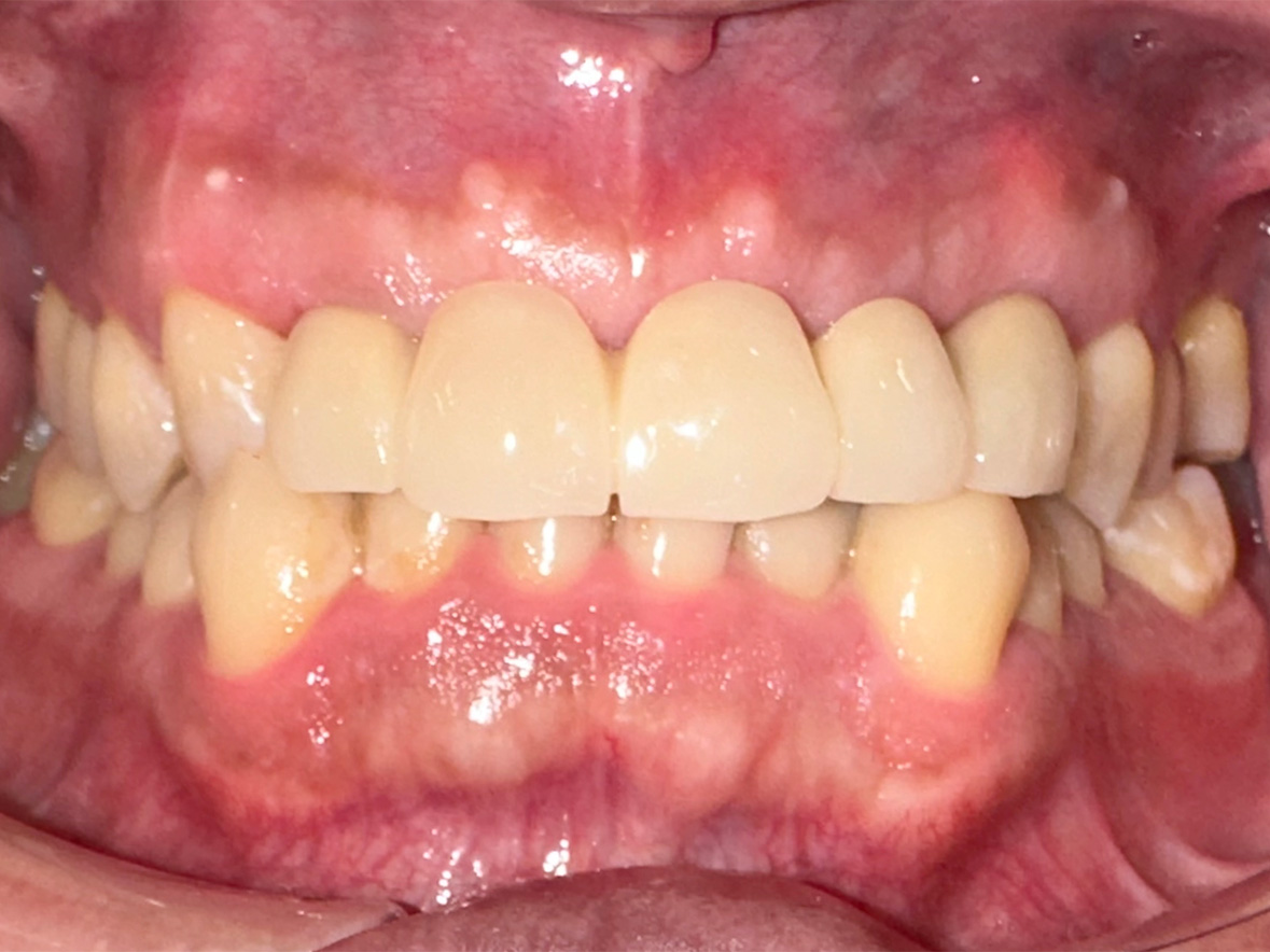 30代男性アフター