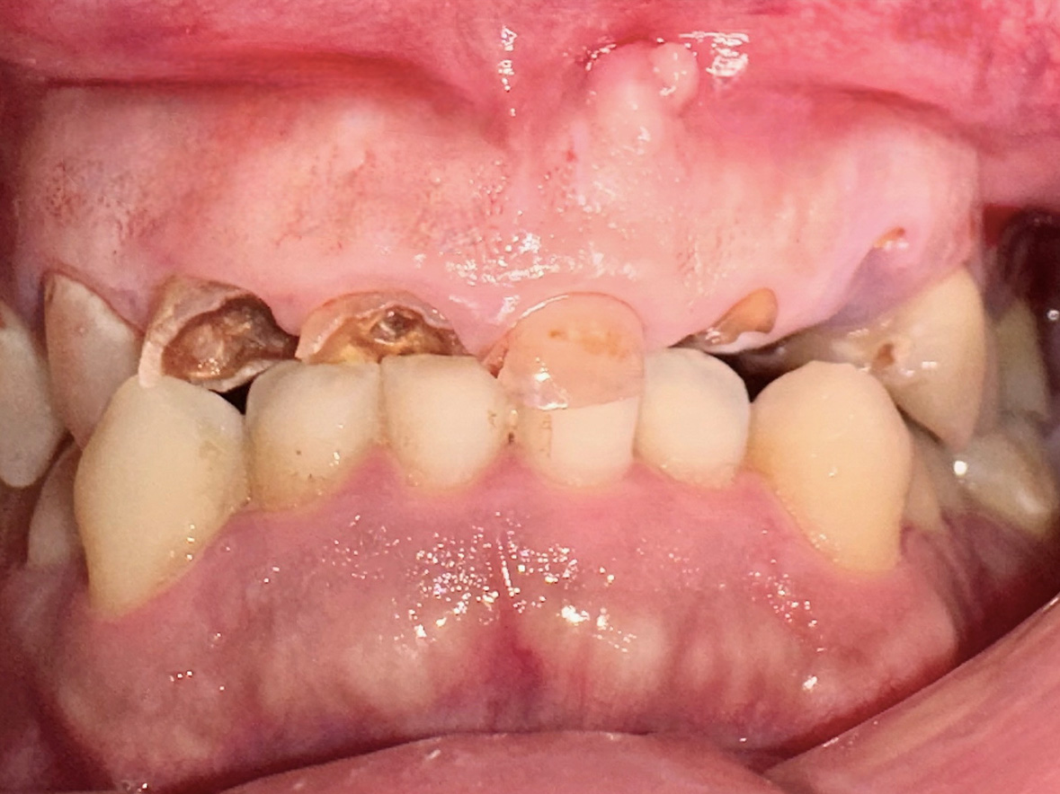 30代男性ビフォー