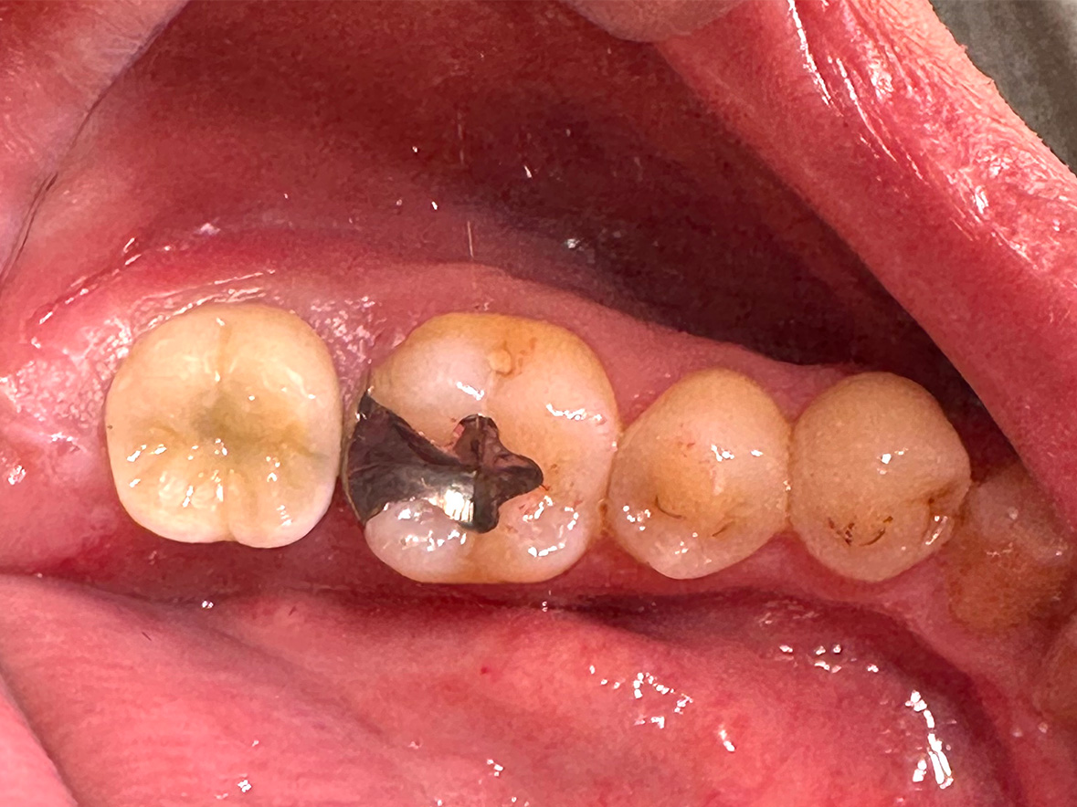 30代男性アフター