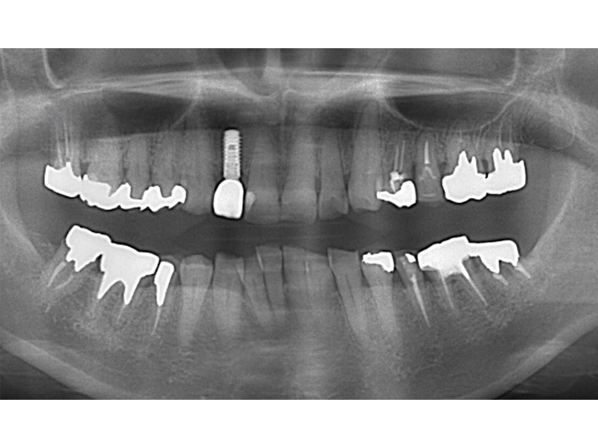 60代女性アフター