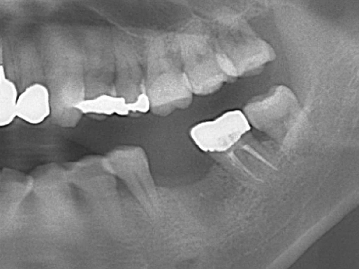 50代男性ビフォー